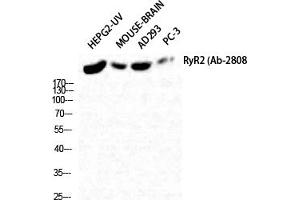 Western Blot analysis of HepG2-UV Mouse-BRAIN AD293 PC-3 cells using RyR-2 Polyclonal Antibody diluted at 1:2000. (RYR2 anticorps)