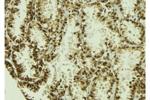 ABIN6273011 at 1/100 staining Human lung tissue by IHC-P. (NUDT21 anticorps  (Internal Region))