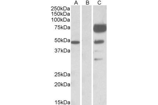 Angiopoietin 1 anticorps  (Internal Region)