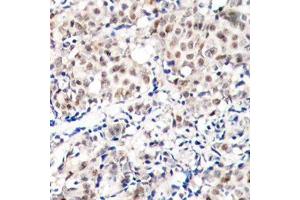 Immunohistochemistry (IHC) image for anti-Cyclin-Dependent Kinase Inhibitor 1B (p27, Kip1) (CDKN1B) (pThr187) antibody (ABIN3020148) (CDKN1B anticorps  (pThr187))