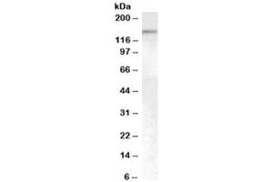 Western blot testing of HeLa cell nuclear lysate with SENP6 antibody at 0. (SENP6 anticorps)