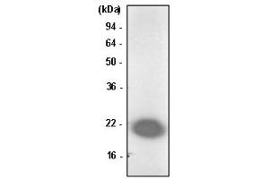 Western Blotting (WB) image for anti-Parkinson Protein 7 (PARK7) antibody (ABIN361043) (PARK7/DJ1 anticorps)