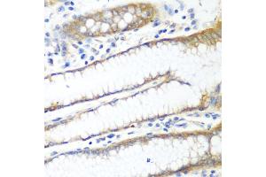 Immunohistochemistry of paraffin-embedded human stomach using PPP4R1 antibody (ABIN5974671) at dilution of 1/100 (40x lens). (PPP4R1 anticorps)