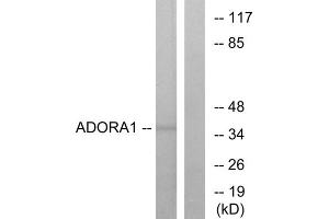 Western blot analysis of extracts from MCF-7 cells, using ADORA1 antibody. (ADORA1 anticorps  (C-Term))