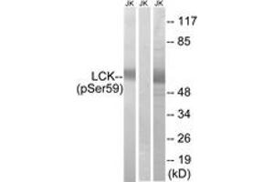Western blot analysis of extracts from Jurkat cells treated with IFN 2500U/ML 30', using LCK (Phospho-Ser59) Antibody. (LCK anticorps  (pSer59))