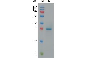Cynomolgus A1 Protein, His Tag on SDS-PAGE under reducing condition. (BTN3A1 Protein (AA 1-218) (His tag))