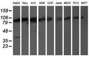 Image no. 2 for anti-Proteasome (Prosome, Macropain) 26S Subunit, Non-ATPase, 2 (PSMD2) antibody (ABIN1500483) (PSMD2 anticorps)