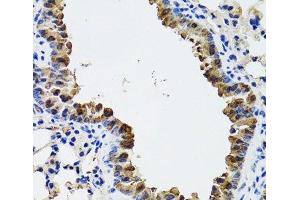 Immunohistochemistry of paraffin-embedded Mouse lung using ESD Polyclonal Antibody at dilution of 1:100 (40x lens). (Esterase D anticorps)