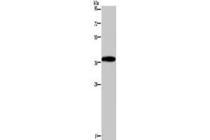 Western Blotting (WB) image for anti-Distal-Less Homeobox 4 (DLX4) antibody (ABIN2429948) (DLX4 anticorps)
