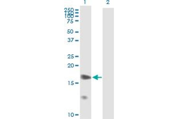 Prostaglandin E Synthase anticorps  (AA 1-152)