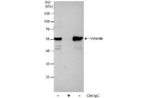 Immunoprecipitation (IP) image for anti-Vimentin (VIM) antibody (ABIN2854814)