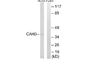 Western blot analysis of extracts from HUVEC cells, using CA3 antibody. (CA3 anticorps)