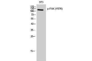 Western Blotting (WB) image for anti-PTK2 Protein tyrosine Kinase 2 (PTK2) (pTyr576) antibody (ABIN3179639) (FAK anticorps  (pTyr576))
