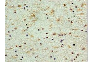 Immunohistochemistry of paraffin-embedded human brain tissue using ABIN7148846 at dilution of 1:100 (CDK1 anticorps  (AA 1-283))