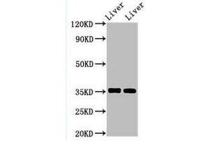 Western Blotting (WB) image for anti-Arginase, Liver (ARG1) (AA 1-322) antibody (ABIN6091458) (Liver Arginase anticorps  (AA 1-322))