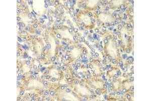 Immunohistochemistry of paraffin-embedded Rat kidney using PRKAB2 Polyclonal Antibody at dilution of 1:100 (40x lens). (PRKAB2 anticorps)