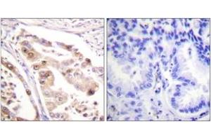 Immunohistochemistry (IHC) image for anti-Replication Protein A2, 32kDa (RPA2) (AA 10-59) antibody (ABIN2888859) (RPA2 anticorps  (AA 10-59))