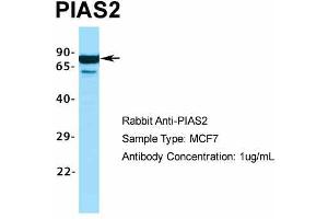 Host:  Rabbit  Target Name:  PIAS2  Sample Type:  MCF7  Antibody Dilution:  1. (PIAS2 anticorps  (C-Term))