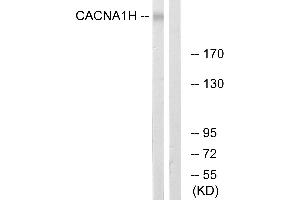 Western blot analysis of extracts from A549 cells, using CACNA1H antibody. (CACNA1H anticorps  (Internal Region))