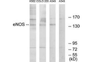 Western blot analysis of extracts from A549/K562/COLO205 cells, using eNOS (Ab-1179) Antibody. (ENOS anticorps  (AA 1145-1194))
