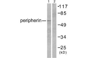 Western Blotting (WB) image for anti-Peripherin (PRPH) (C-Term) antibody (ABIN1848741) (Peripherin anticorps  (C-Term))