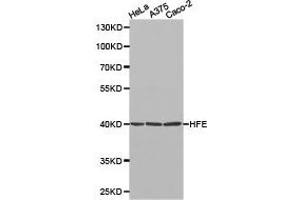 Western Blotting (WB) image for anti-Hemochromatosis (HFE) antibody (ABIN1872964) (HFE anticorps)