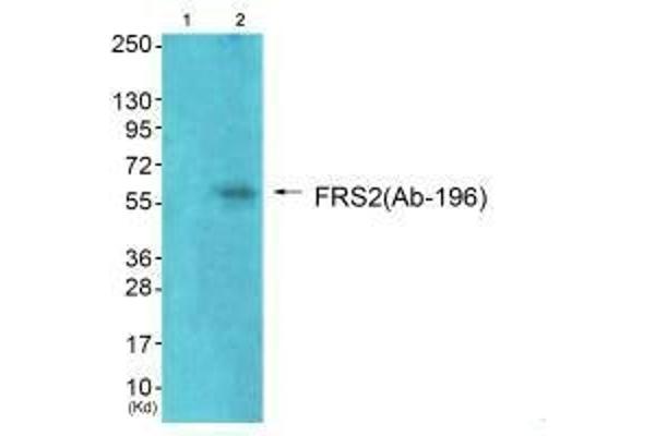 FRS2 anticorps  (Tyr196)