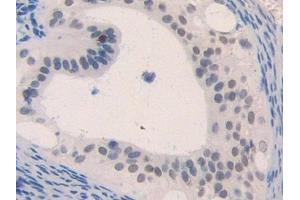 Used in DAB staining on fromalin fixed paraffin- embedded lung tissue (CCL4 anticorps  (AA 24-92))