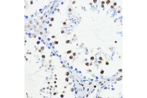 Immunohistochemistry of paraffin-embedded mouse testis using ZEB1 antibody (ABIN6129933, ABIN6150422, ABIN6150423 and ABIN6221237) at dilution of 1:200 (40x lens). (ZEB1 anticorps  (AA 1-260))