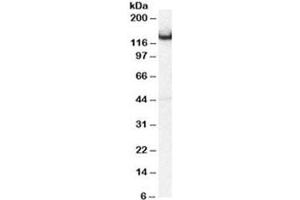 Western blot testing of mouse brain lysate with Amphiphysin antibody at 0. (Amphiphysin anticorps)