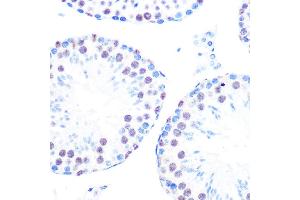 Immunohistochemistry of paraffin-embedded mouse testis using Cyclin H Rabbit mAb (ABIN7266569) at dilution of 1:100 (40x lens). (Cyclin H anticorps)