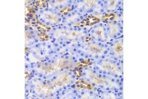 Immunohistochemistry of paraffin-embedded Rat kidney using DIAPH1 antibody at dilution of 1:100 (x40 lens). (DIAPH1 anticorps)