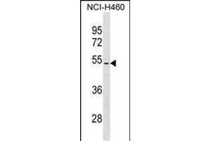 PTEN Antibody (/) (ABIN6242543 and ABIN6577361) western blot analysis in NCI- cell line lysates (35 μg/lane). (PTEN anticorps  (AA 361-390))