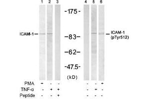 Image no. 1 for anti-Intercellular Adhesion Molecule 1 (ICAM1) (Tyr512) antibody (ABIN197276) (ICAM1 anticorps  (Tyr512))