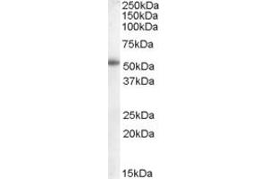 Western Blotting (WB) image for anti-Epithelial Splicing Regulatory Protein 2 (ESRP2) (N-Term) antibody (ABIN2156786) (ESRP2 anticorps  (N-Term))