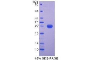 SDS-PAGE (SDS) image for Ferritin, Light Polypeptide (FTL) (AA 1-175) protein (His tag) (ABIN1878765) (FTL Protein (AA 1-175) (His tag))