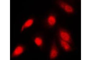 Immunofluorescent analysis of NF-kappaB p65 (pS311) staining in PC12 cells. (NF-kB p65 anticorps  (pSer311))
