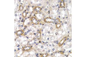Immunohistochemistry of paraffin-embedded rat kidney using CD38 antibody at dilution of 1:200 (400x lens). (CD38 anticorps)