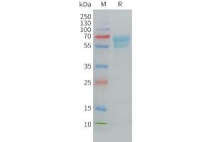 Cynomolgus CD7 Protein, hFc Tag on SDS-PAGE under reducing condition. (CD7 Protein (CD7) (AA 26-177) (Fc Tag))