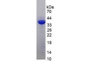 SDS-PAGE analysis of Human Adrenocorticotropic Hormone Protein. (POMC Protéine)