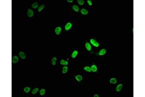 Immunofluorescence (IF) image for anti-Lamin A/C (LMNA) antibody (ABIN7127601)