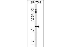 PTRH1 Antibody (Center) (ABIN1537717 and ABIN2849316) western blot analysis in ZR-75-1 cell line lysates (35 μg/lane). (PTRH1 anticorps  (AA 102-129))