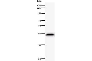 Western Blotting (WB) image for anti-Asparaginyl-tRNA Synthetase (NARS) antibody (ABIN932996) (NARS anticorps)