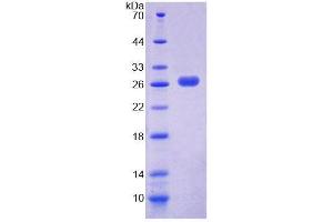 SDS-PAGE analysis of Mouse PEX1 Protein. (PEX1 Protéine)