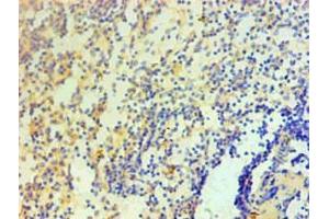 Immunohistochemical of paraffin-embedded Human spleen tissue using ABIN7156047 at dilution of 1:200. (IL1A anticorps)