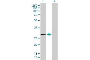 Western Blot analysis of HMOX1 expression in transfected 293T cell line by HMOX1 MaxPab polyclonal antibody. (HMOX1 anticorps  (AA 1-288))