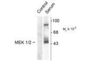 Image no. 2 for anti-Mitogen-Activated Protein Kinase Kinase 1 (MAP2K1) (pSer218), (Ser222) antibody (ABIN221121) (MEK1 anticorps  (pSer218, Ser222))