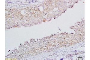 Immunohistochemistry (Paraffin-embedded Sections) (IHC (p)) image for anti-Follicle Stimulating Hormone Receptor (FSHR) (AA 201-300) antibody (ABIN729508)