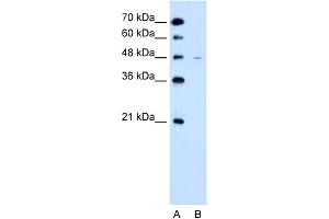 WB Suggested Anti-SLC43A3 Antibody Titration:  2. (SLC43A3 anticorps  (N-Term))