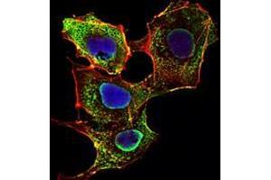 Immunofluorescence analysis of NIH/3T3 cells using SMAD3 mouse mAb (green). (SMAD3 anticorps)